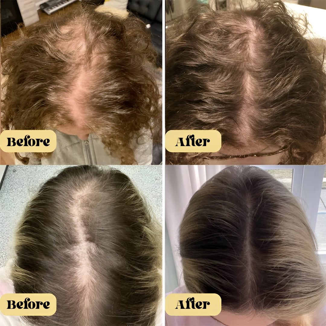 BareBloom™ Vegan Hair Growth Oil